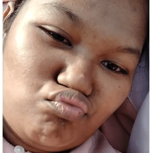 Rania lop mas bule hot jeletot 