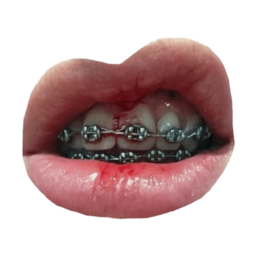labios. boca 👄💋 preview