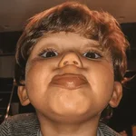 Reações bebes